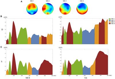 The accuracy of different mismatch negativity amplitude representations in predicting the levels of consciousness in patients with disorders of consciousness